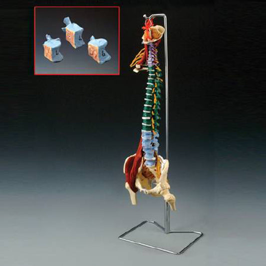 Anatomical Chart Company Muscle Spine Model, Sold As 1/Each Wolter Ch5900